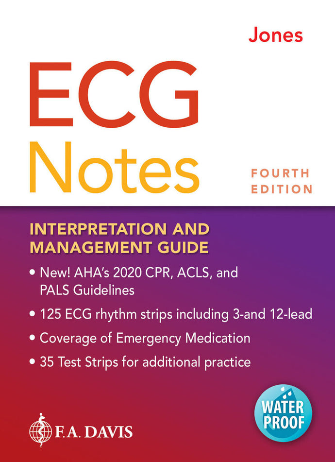 *PRE-ORDER, APPROX 2-5 BUSINESS DAYS* ECG Notes Interpretation and Management Guide 4th edition by Shirley A. Jones 9781719641944 *2d