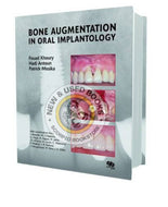 *PRE-ORDER, APPROX 7-10 BUSINESS DAYS* Bone Augmentation in Oral Implantology by Khoury 9781850971597