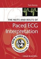 *PRE-ORDER, APPROX 7-14 BUSINESS DAYS, print-on-demand* The Nuts and bolts of Paced ECG Interpretation by Tom Kenny 9781405184045 [ZZ]