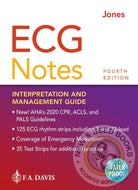 *PRE-ORDER, APPROX 2-4 BUSINESS DAYS* ECG Notes Interpretation and Management Guide 4th edition by Shirley A. Jones 9781719641944 [ZZ]
