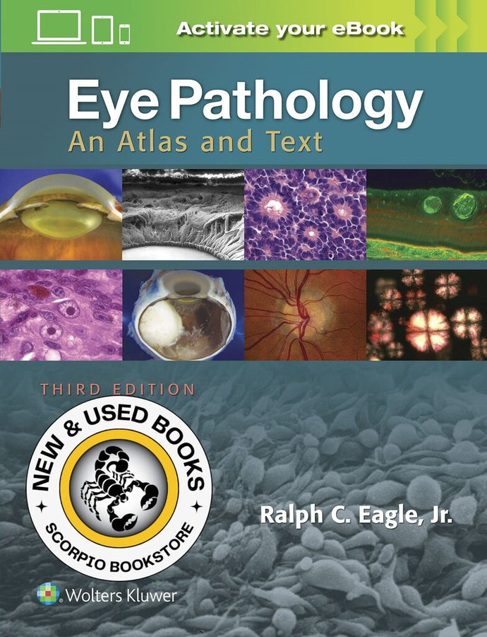 *PRE-ORDER, APPROX 7-10 BUSINESS DAYS* Eye Pathology 3rd Edition by Ralph C. Eagle Jr 9781496337177 [ZZ]