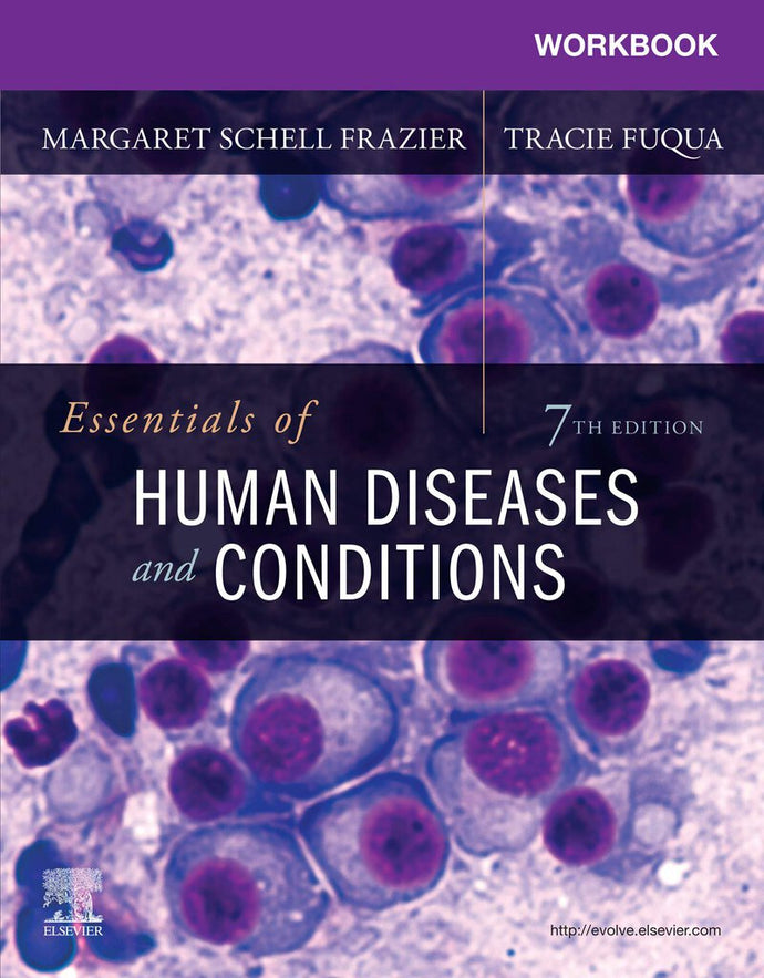 Essentials of Human Diseases and Conditions 7th edition by Margaret Schell Frazier 9780323712675 *110e